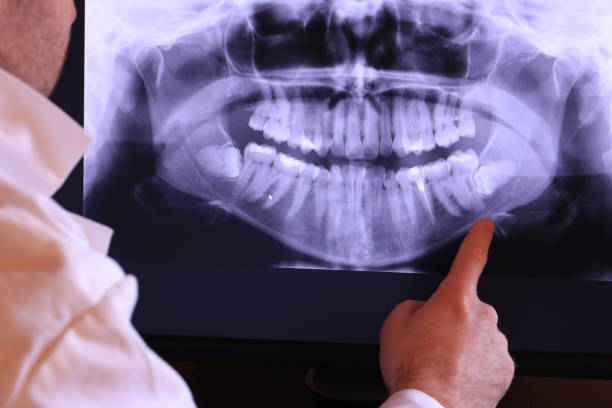 Best Emergency Denture Repair in Peoria, AZ