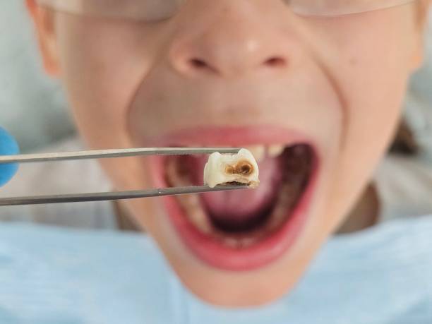 Best Emergency Gum Treatment in Peoria, AZ
